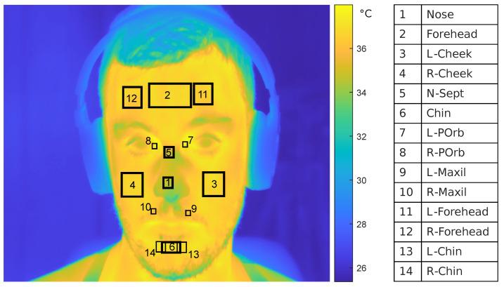 https://cdn.ncbi.nlm.nih.gov/pmc/blobs/5f89/8839779/52ed05f529d3/sensors-22-00976-g002.jpg