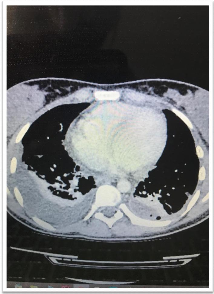 https://cdn.ncbi.nlm.nih.gov/pmc/blobs/5f8b/9801570/3be4387fe98e/13256_2022_3702_Fig3_HTML.jpg