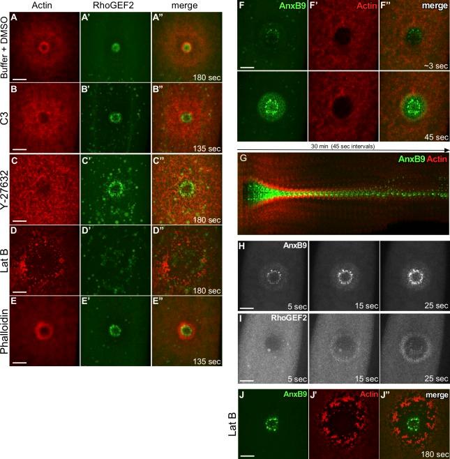 https://cdn.ncbi.nlm.nih.gov/pmc/blobs/5f8c/5716286/26d0aea1fcdd/JCB_201704145_Fig4.jpg