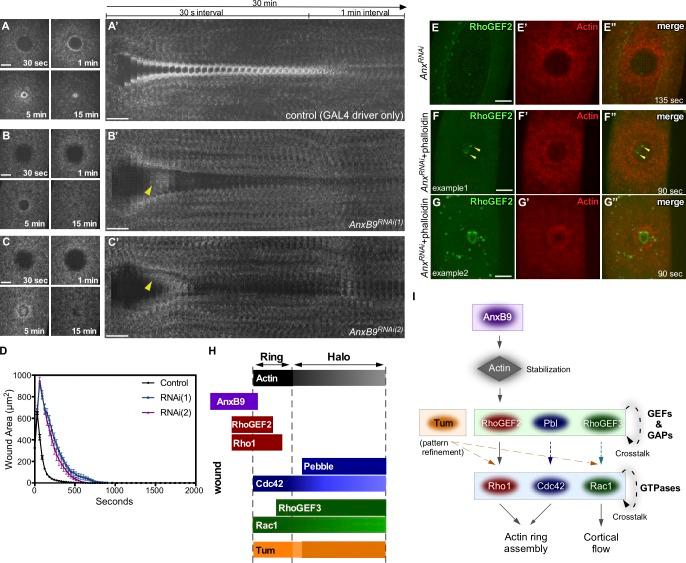 https://cdn.ncbi.nlm.nih.gov/pmc/blobs/5f8c/5716286/ba8bb15cfebf/JCB_201704145_Fig5.jpg