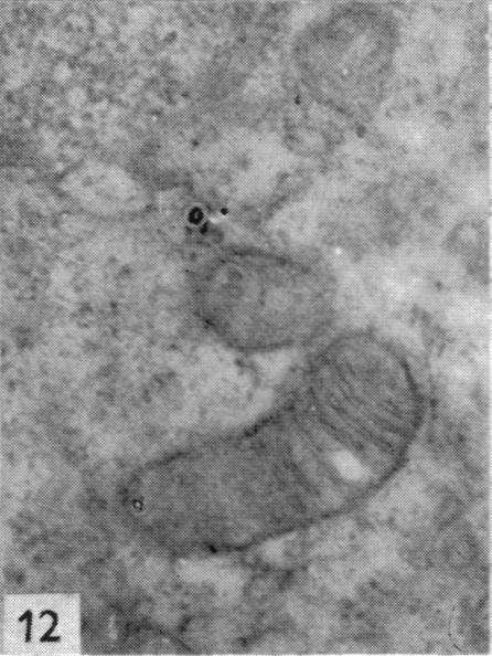 https://cdn.ncbi.nlm.nih.gov/pmc/blobs/5f8e/1244887/0f9c5d40bbf1/janat00451-0104-g.jpg