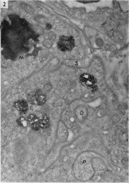 https://cdn.ncbi.nlm.nih.gov/pmc/blobs/5f8e/1244887/a3e596d23e18/janat00451-0103-b.jpg