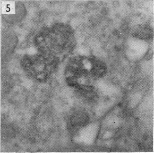 https://cdn.ncbi.nlm.nih.gov/pmc/blobs/5f8e/1244887/a72d5f9c0b46/janat00451-0103-e.jpg