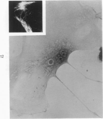 https://cdn.ncbi.nlm.nih.gov/pmc/blobs/5f92/2032439/4e9e56e3b20c/amjpathol00449-0215-a.jpg