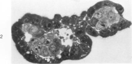 https://cdn.ncbi.nlm.nih.gov/pmc/blobs/5f92/2032439/72033a1ddfaf/amjpathol00449-0212-a.jpg