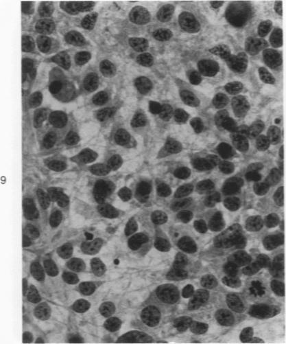 https://cdn.ncbi.nlm.nih.gov/pmc/blobs/5f92/2032439/82ad917d1407/amjpathol00449-0214-a.jpg