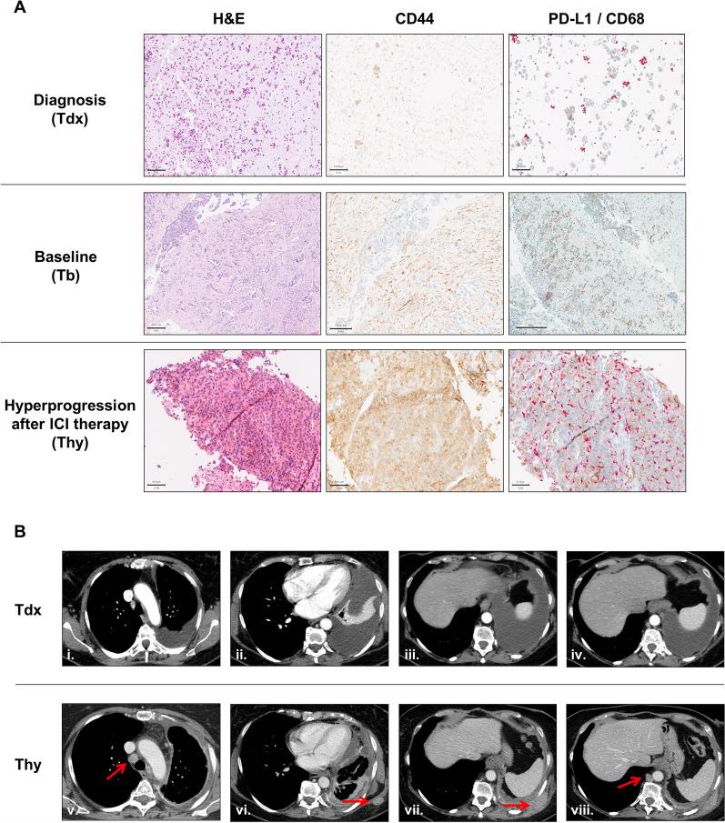 https://cdn.ncbi.nlm.nih.gov/pmc/blobs/5f9f/11697469/679a9bb8c123/12967_2024_6023_Fig1_HTML.jpg