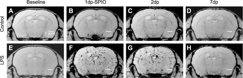 https://cdn.ncbi.nlm.nih.gov/pmc/blobs/5fa2/4597836/9da875e85cd5/mri-suppl.1-2015-015f4.jpg