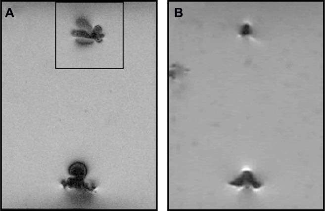 https://cdn.ncbi.nlm.nih.gov/pmc/blobs/5fa2/4597836/9e1c9144e0ac/mri-suppl.1-2015-015f1.jpg