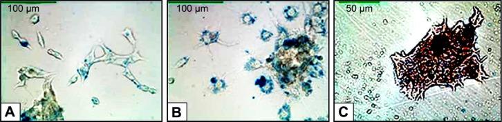 https://cdn.ncbi.nlm.nih.gov/pmc/blobs/5fa2/4597836/e8dd4141e687/mri-suppl.1-2015-015f3.jpg