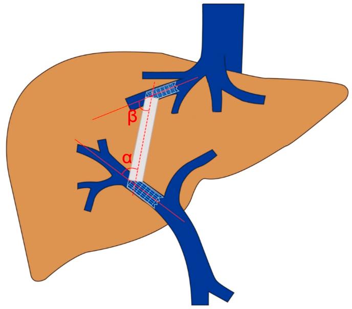 https://cdn.ncbi.nlm.nih.gov/pmc/blobs/5fa2/8562232/bb69b286a38b/gr1.jpg