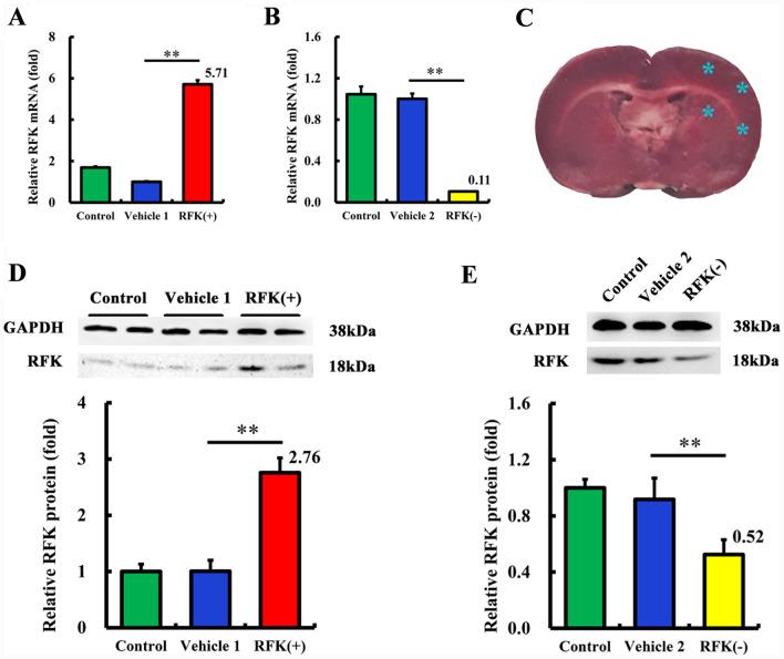 https://cdn.ncbi.nlm.nih.gov/pmc/blobs/5fa7/11966939/d1e07fdbb038/10020_2025_1170_Fig1_HTML.jpg