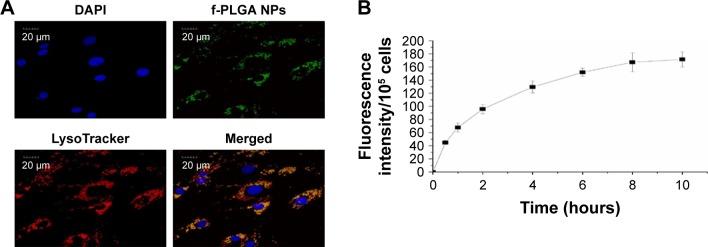 https://cdn.ncbi.nlm.nih.gov/pmc/blobs/5faa/6136913/41a4e264d288/ijn-13-5231Fig4.jpg