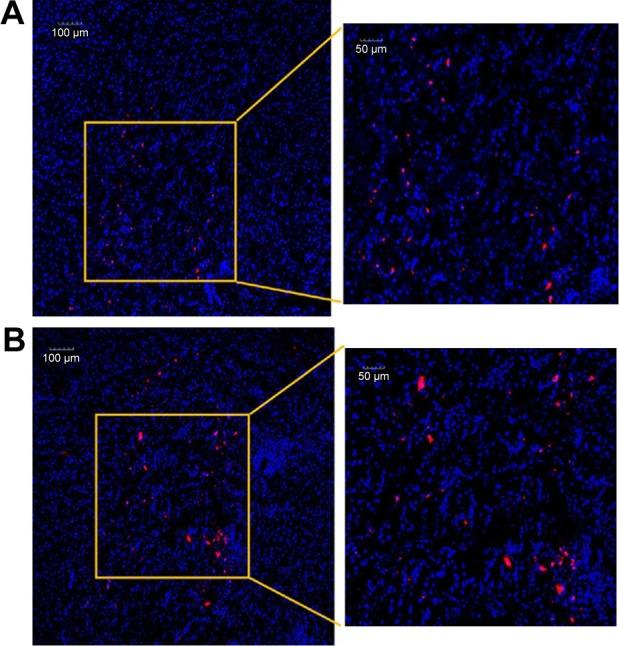 https://cdn.ncbi.nlm.nih.gov/pmc/blobs/5faa/6136913/4f9af74024a1/ijn-13-5231Fig9.jpg
