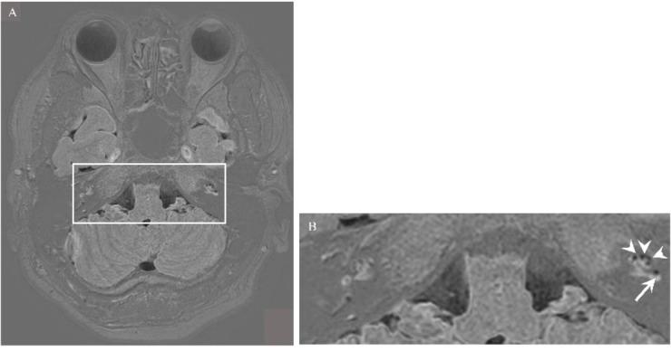 https://cdn.ncbi.nlm.nih.gov/pmc/blobs/5fac/11686369/91209dd3235b/41598_2024_83367_Fig8_HTML.jpg