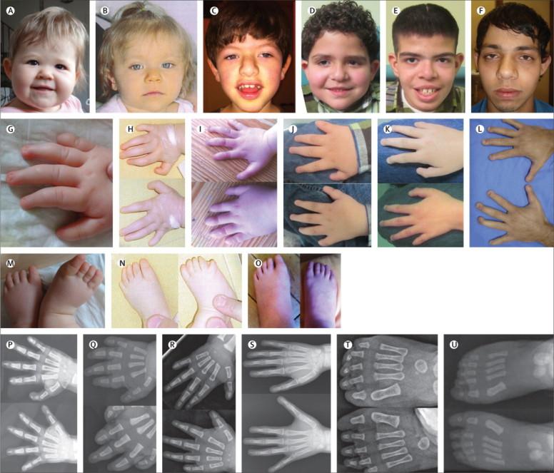 https://cdn.ncbi.nlm.nih.gov/pmc/blobs/5fac/3895324/bcd923256cb4/gr2.jpg