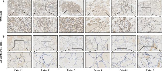 https://cdn.ncbi.nlm.nih.gov/pmc/blobs/5fad/12217172/e32298e13248/41598_2025_5747_Fig4_HTML.jpg