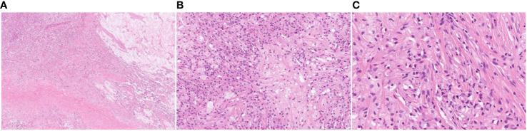 https://cdn.ncbi.nlm.nih.gov/pmc/blobs/5faf/10924307/1506ac03864f/fonc-14-1290757-g003.jpg