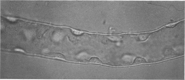 https://cdn.ncbi.nlm.nih.gov/pmc/blobs/5faf/322672/e1177b548203/jcinvest00226-0087-a.jpg
