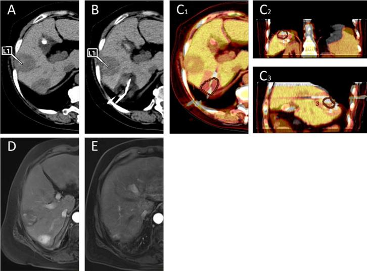 https://cdn.ncbi.nlm.nih.gov/pmc/blobs/5fb2/8562177/f27e191eda58/gr1.jpg
