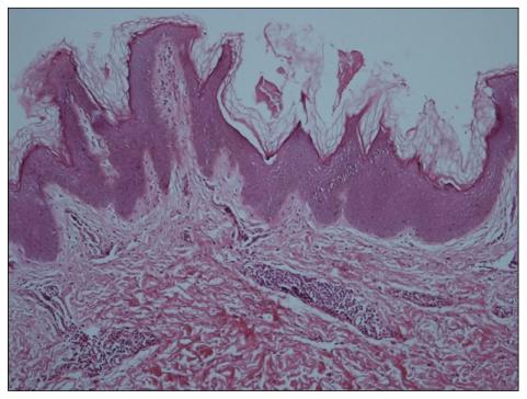 https://cdn.ncbi.nlm.nih.gov/pmc/blobs/5fc6/3229067/e5ca62035040/ad-23-S208-g002.jpg