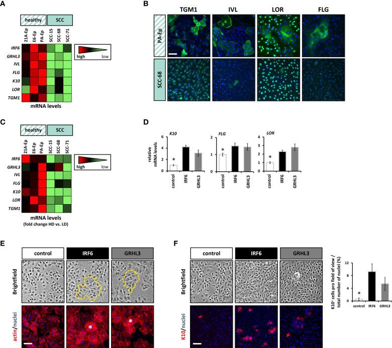 https://cdn.ncbi.nlm.nih.gov/pmc/blobs/5fc6/9706198/4d3c8260b338/fonc-12-1023072-g004.jpg