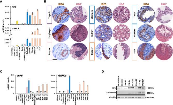 https://cdn.ncbi.nlm.nih.gov/pmc/blobs/5fc6/9706198/ca76e17ea3ff/fonc-12-1023072-g001.jpg
