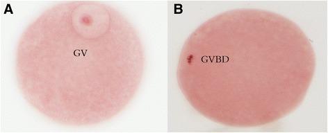 https://cdn.ncbi.nlm.nih.gov/pmc/blobs/5fca/5450137/94cbb39d18be/12958_2017_258_Fig3_HTML.jpg