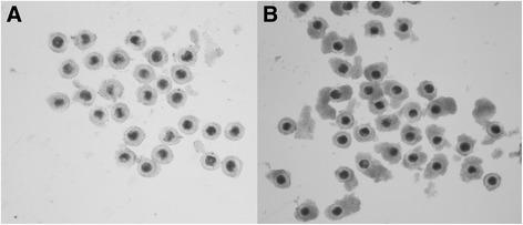 https://cdn.ncbi.nlm.nih.gov/pmc/blobs/5fca/5450137/979b9b8a5c01/12958_2017_258_Fig4_HTML.jpg