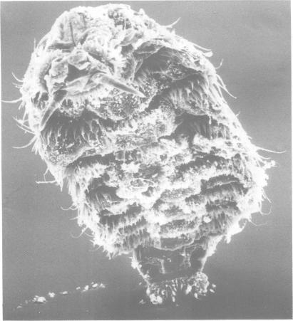 https://cdn.ncbi.nlm.nih.gov/pmc/blobs/5fce/1042536/213e7edb5c87/brjopthal00573-0064-a.jpg