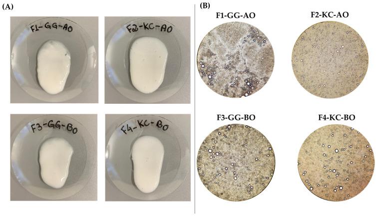 https://cdn.ncbi.nlm.nih.gov/pmc/blobs/5fd6/11597777/73236c22ae3e/pharmaceutics-16-01426-g002.jpg