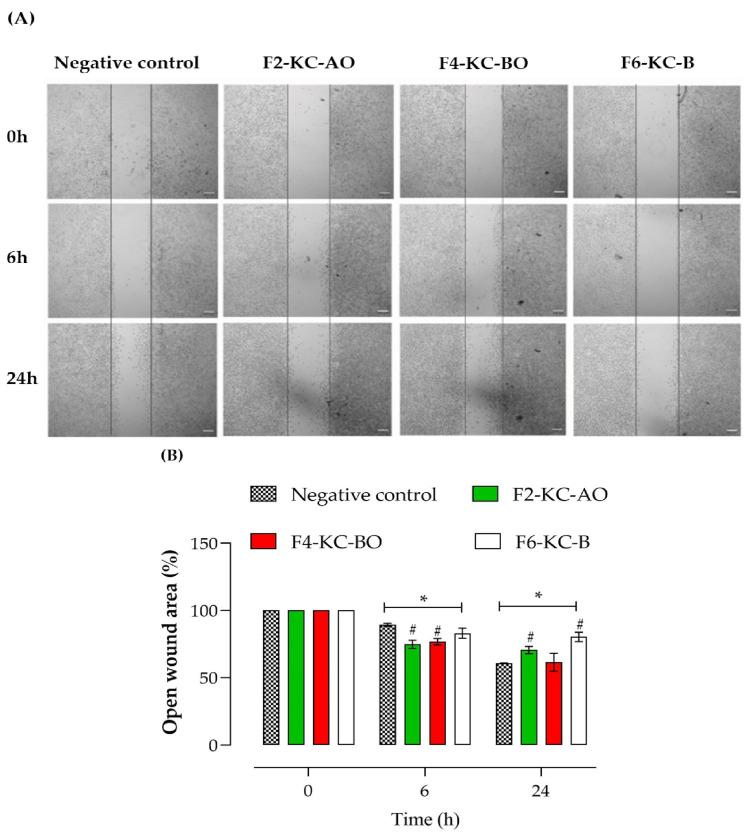 https://cdn.ncbi.nlm.nih.gov/pmc/blobs/5fd6/11597777/9dc27f019b2d/pharmaceutics-16-01426-g013.jpg