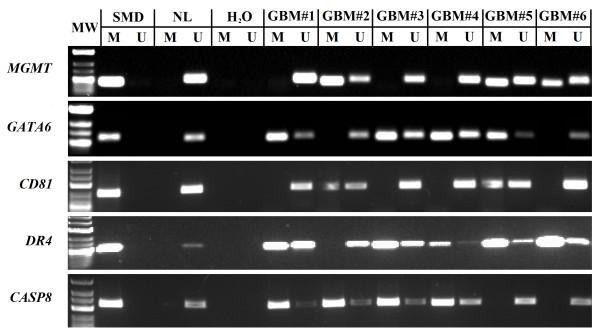 https://cdn.ncbi.nlm.nih.gov/pmc/blobs/5fd6/3404983/f04bc3466bc3/1471-2407-12-218-1.jpg