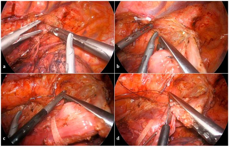 https://cdn.ncbi.nlm.nih.gov/pmc/blobs/5fdc/11475372/87386a626ee3/cancers-16-03281-g003.jpg