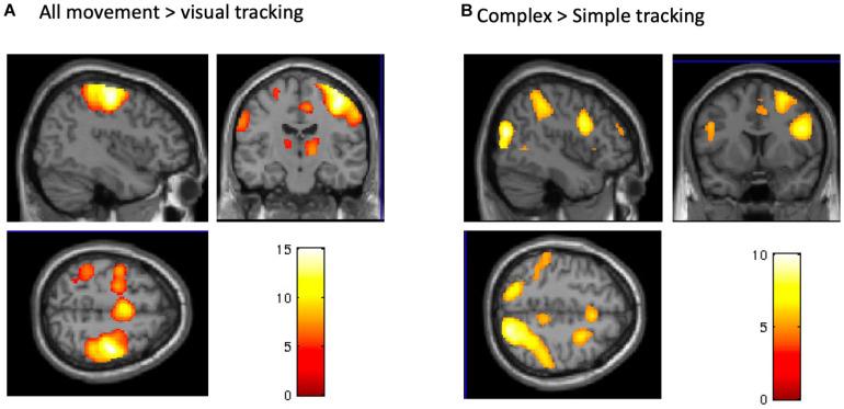 https://cdn.ncbi.nlm.nih.gov/pmc/blobs/5fdf/7982814/62983e45ce9b/fnhum-15-639274-g005.jpg