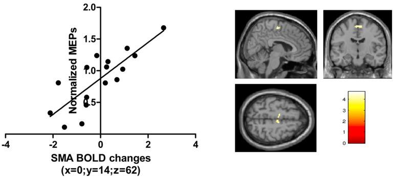 https://cdn.ncbi.nlm.nih.gov/pmc/blobs/5fdf/7982814/9fe938527d2e/fnhum-15-639274-g006.jpg