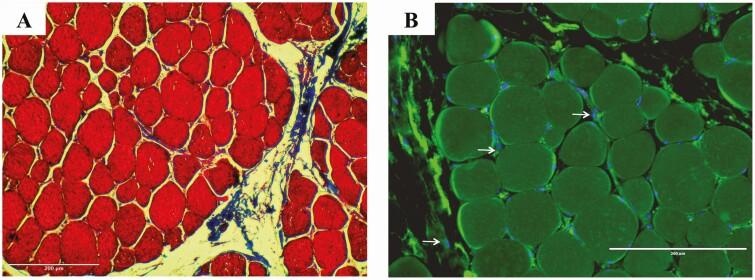 https://cdn.ncbi.nlm.nih.gov/pmc/blobs/5fe3/8683153/bc4273e858c8/vfab061f0001.jpg