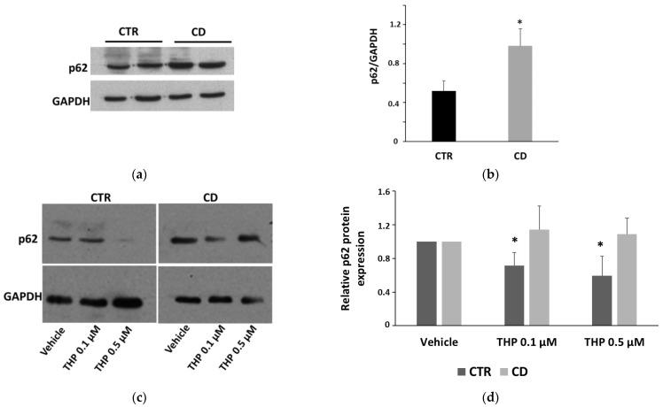 https://cdn.ncbi.nlm.nih.gov/pmc/blobs/5fe8/9866799/46ec9ba07574/ijms-24-01495-g007.jpg