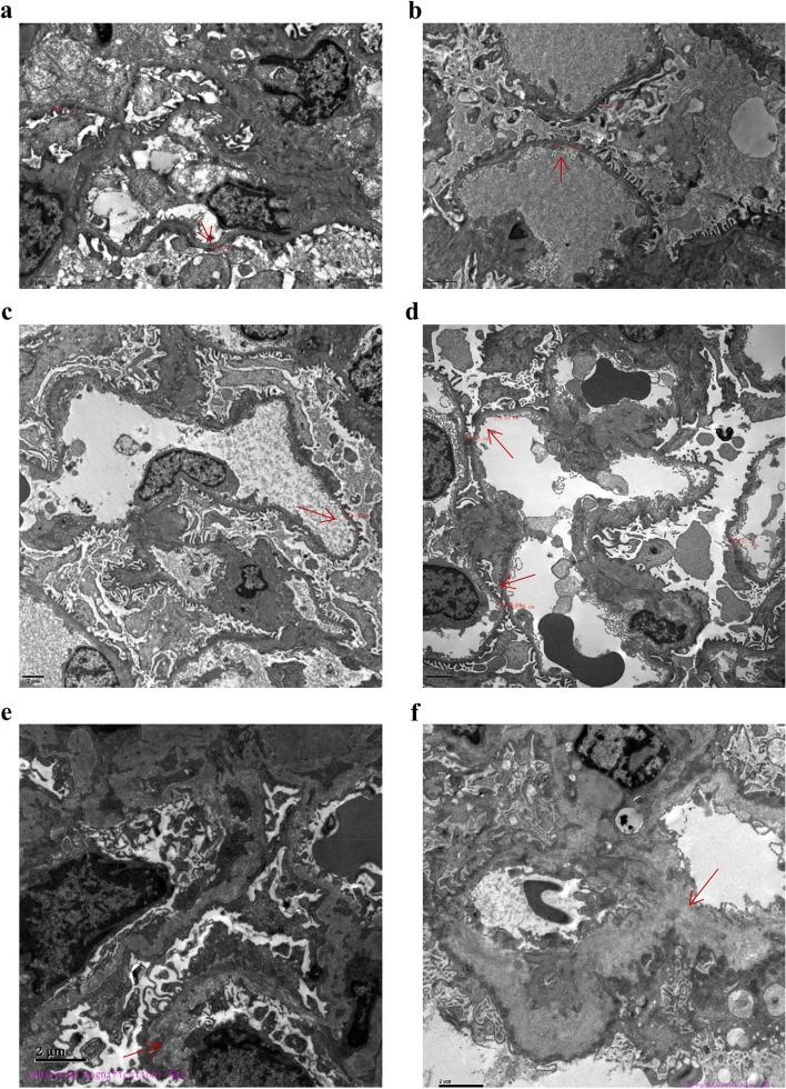 https://cdn.ncbi.nlm.nih.gov/pmc/blobs/5fe9/11229269/63ef8e1ec316/12920_2024_1953_Fig1_HTML.jpg