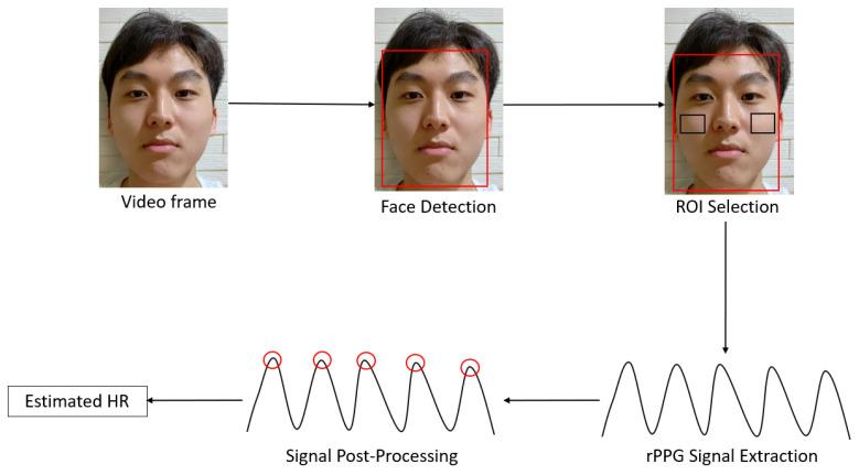 https://cdn.ncbi.nlm.nih.gov/pmc/blobs/5fee/8473186/bf6f185a7179/sensors-21-06296-g002.jpg