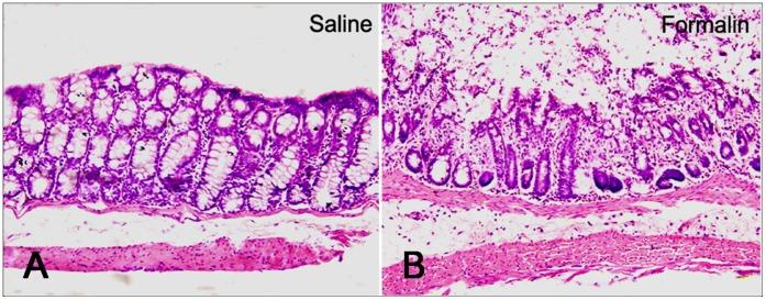 https://cdn.ncbi.nlm.nih.gov/pmc/blobs/5ff1/3605455/5e051c8e2370/pone.0059234.g002.jpg