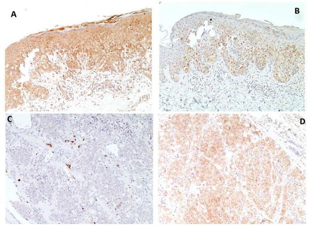https://cdn.ncbi.nlm.nih.gov/pmc/blobs/5ff2/8353102/9a6691bff80e/fmed-08-688105-g0003.jpg