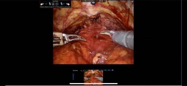 https://cdn.ncbi.nlm.nih.gov/pmc/blobs/5ff2/8571977/902f79b3110a/11701_2021_1330_Fig5_HTML.jpg