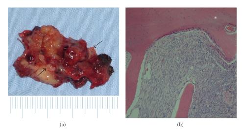 https://cdn.ncbi.nlm.nih.gov/pmc/blobs/5ff8/3010644/e75d527f0c57/IJOL2010-154948.003.jpg