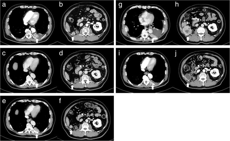 https://cdn.ncbi.nlm.nih.gov/pmc/blobs/5ffe/6475964/7f99abe701d0/13256_2019_2041_Fig2_HTML.jpg