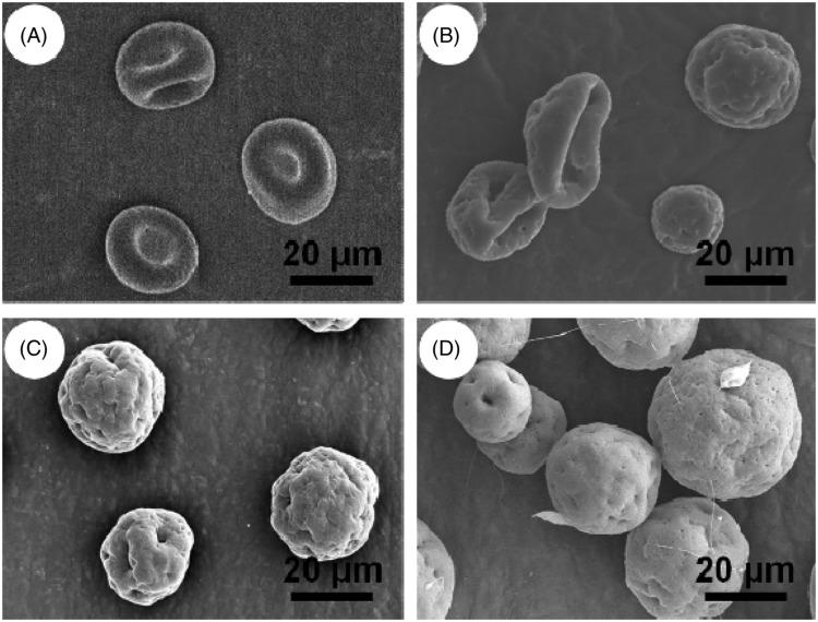 https://cdn.ncbi.nlm.nih.gov/pmc/blobs/5fff/3709885/edf2269a9be1/MNC-30-490-g003.jpg
