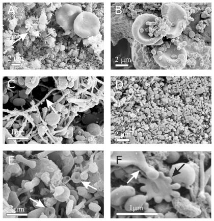 https://cdn.ncbi.nlm.nih.gov/pmc/blobs/6001/3225219/859300566f8c/ijn-6-2737f2.jpg