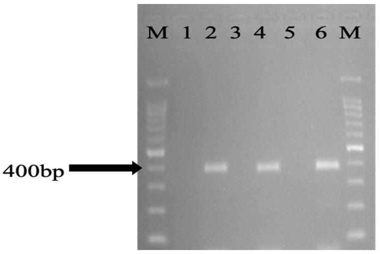 https://cdn.ncbi.nlm.nih.gov/pmc/blobs/6007/9598899/18f4d83dfbaf/antibiotics-11-01275-g002.jpg