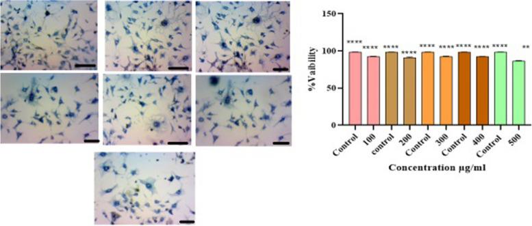 https://cdn.ncbi.nlm.nih.gov/pmc/blobs/6008/11234661/e0c5619aae38/12906_2024_4532_Fig2_HTML.jpg