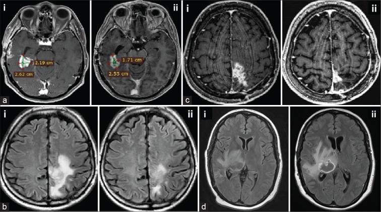https://cdn.ncbi.nlm.nih.gov/pmc/blobs/6009/7710475/e953b4cabbd6/SNI-11-389-g003.jpg